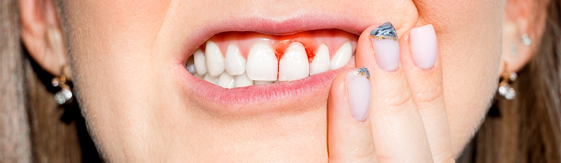 Periodontal Disease Specialist in Fayetteville GA